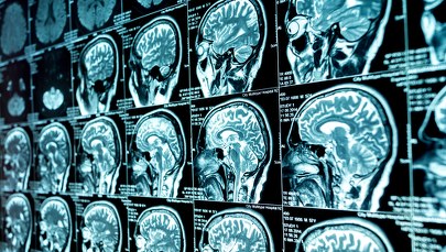 Mózgi nastolatków starzeją się niepokojąco szybko. Winna pandemia