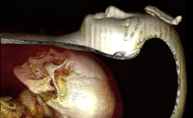 Mumia cyfrowo "odwinięta" odkryła swoje tajemnice