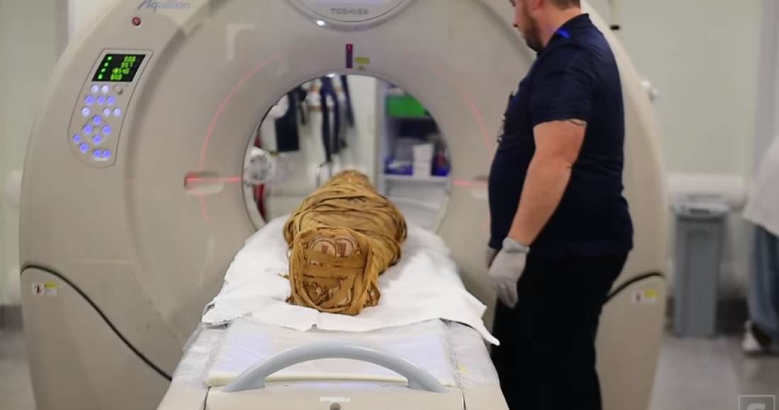 Mumia została poddana badaniu tomografii komputerowej /materiały prasowe
