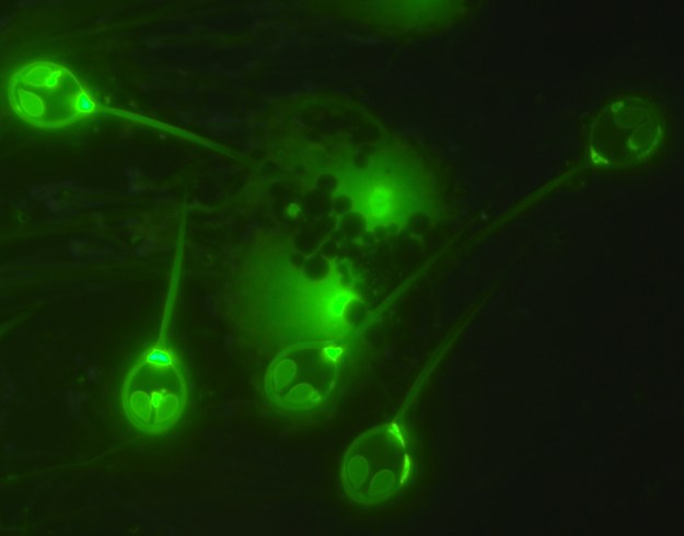 Myksosporydiowce Henneguya salminicola pod mikroskopem fluorescencyjnym /Stephen Douglas Atkinson - Oregon State University /Materiały prasowe