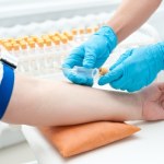 Myślą, że przed badaniem krwi jest to zakazane. Zrób pół godziny przed