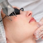 laseroterapia Na celowniku lasera. Odmłodzenie i leczenie