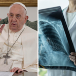 Na co choruje papież? "Miewa problemy z oddychaniem"