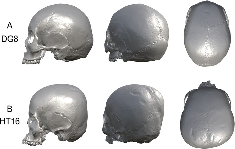 Na górze czaszka ludu Doigahama, na dole czaszka ludu Hirota /Seguchi N, Loftus JF III, Yonemoto S, Murphy M-M (2023) Investigating intentional cranial modification: A hybridized two-dimensional/three-dimensional study of the Hirota site, Tanegashima, Japan. PLo /materiały prasowe