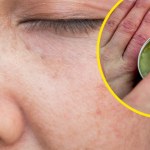 Na obolałe mięśnie, suchą skórę, żylaki i hemoroidy. Maść konopna ma szerokie zastosowanie