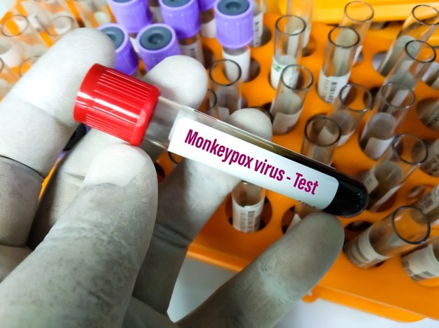 KE kupiła ponad 100 tys. dawek szczepionki przeciw małpiej ospie