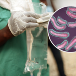 Na świecie rośnie liczba przypadków cholery. Choroba może doprowadzić do śmierci w kilka godzin