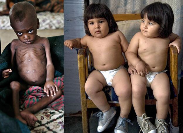 Na zdj. Etiopskie dziecko i, dla porównania, 18 miesięczne bliźnięta z Kolumbii ważące po 16 kg. /AFP