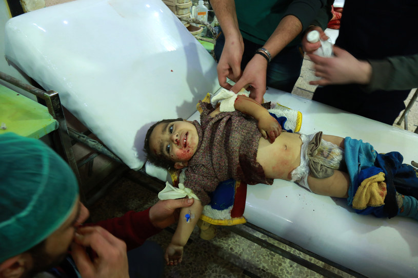 Na zdjęciu: Poszkodowane w nalocie syryjskie dziecko /HAMZA AL-AJWEH /AFP