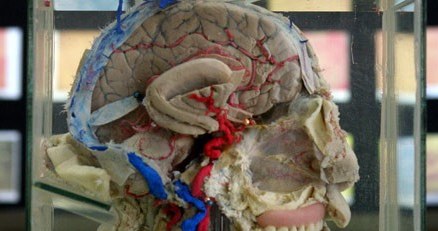 Na zdjęciu: przekrój mózgu w Muzeum Mózgu w Limie, marzec 2005 /AFP