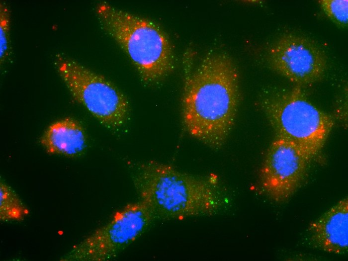 Na zdjęciu widać stworzone przez naukowców nanocząsteczki (kolor czerwony), atakujące komórki nowotworowe (kolor niebieski) /Nature Nanotechnology