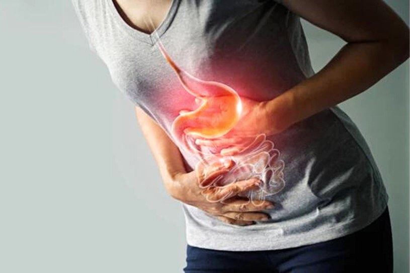 Nadkwasota żołądka może być objawem zapalenia błony śluzowej żołądka, niedrożności ujścia żołądka lub zakażenia Helicobacter pylori /123RF/PICSEL