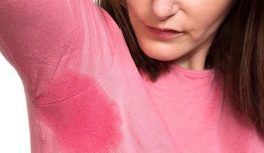 Nadmierna potliwość