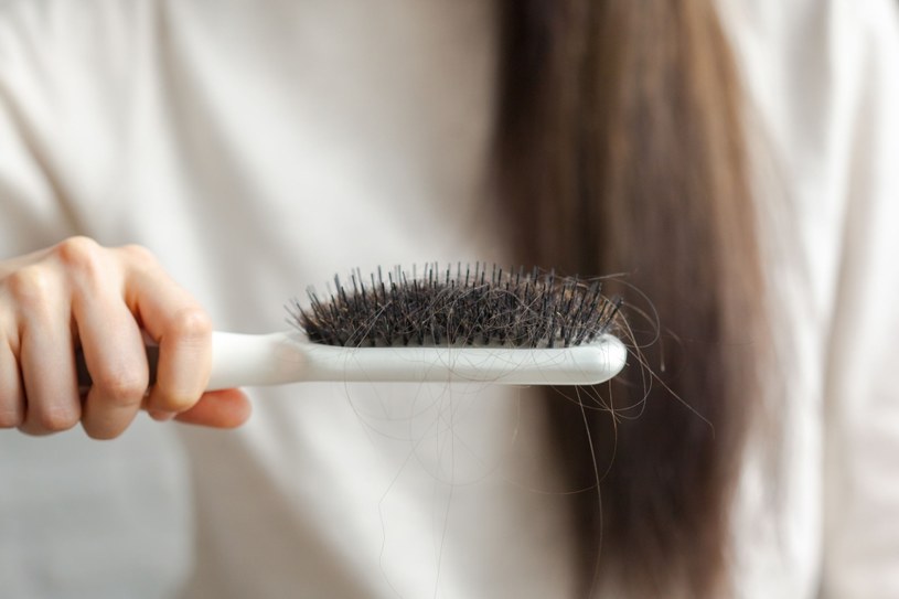 Nadmierne wypadanie włosów to też jeden z objawów zawału /123RF/PICSEL