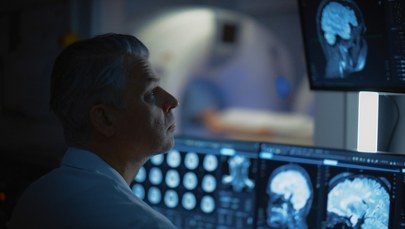 Nadzieja dla pacjentów z glejakiem? Wiemy, kto może skorzystać terapii