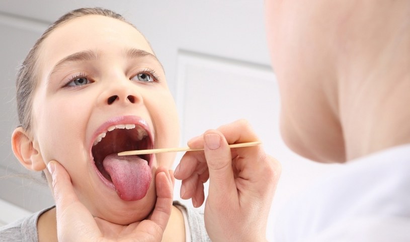 Nagietek leczy stany zapalne jamy ustnej /© Photogenica