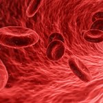 Najnowsze odkrycie: Grupa krwi wpływa na... ryzyko wcześniejszego udaru