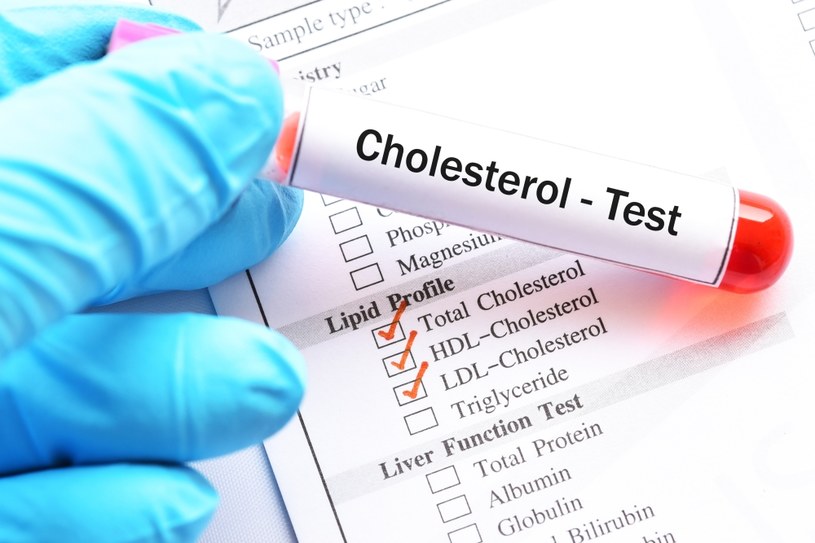 Najskuteczniejsza broń w walce z cholesterolem to dieta. Poznaj jej zasady /123RF/PICSEL