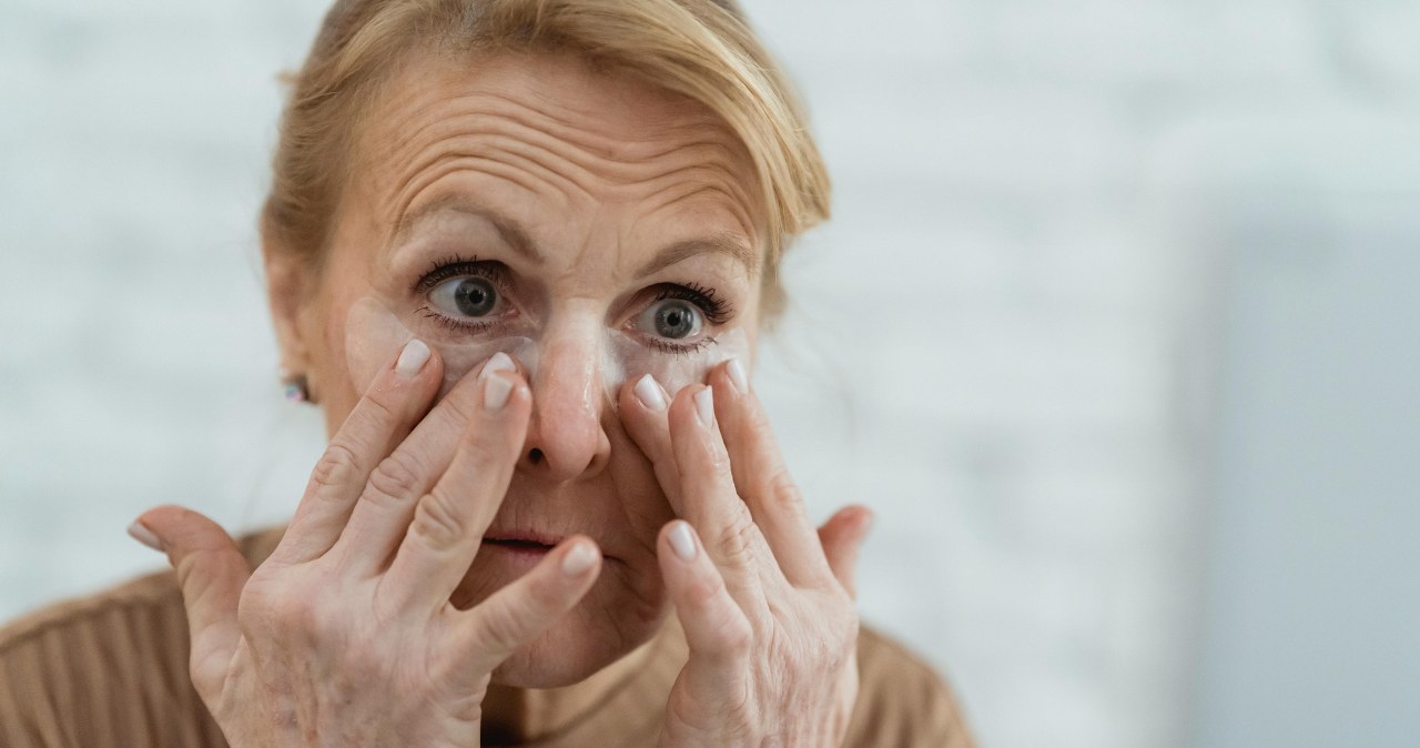 Najskuteczniejszy sposób na cienie pod oczami to maść arnikowa /Teona Swift /Pexels.com