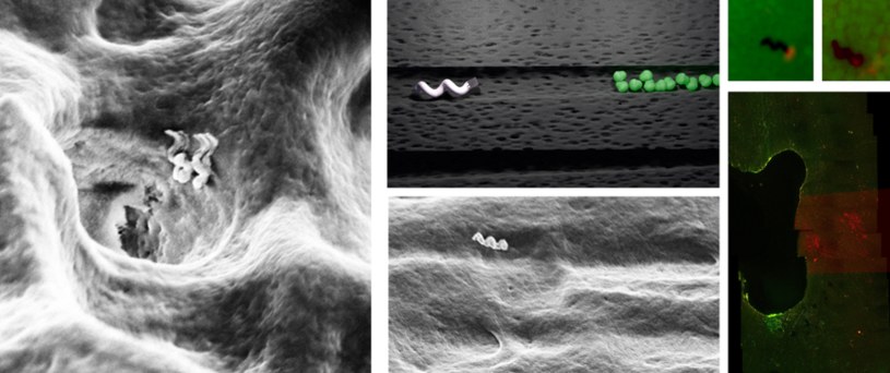 Nanoboty wnikające do kanalików zębinowych /materiały prasowe