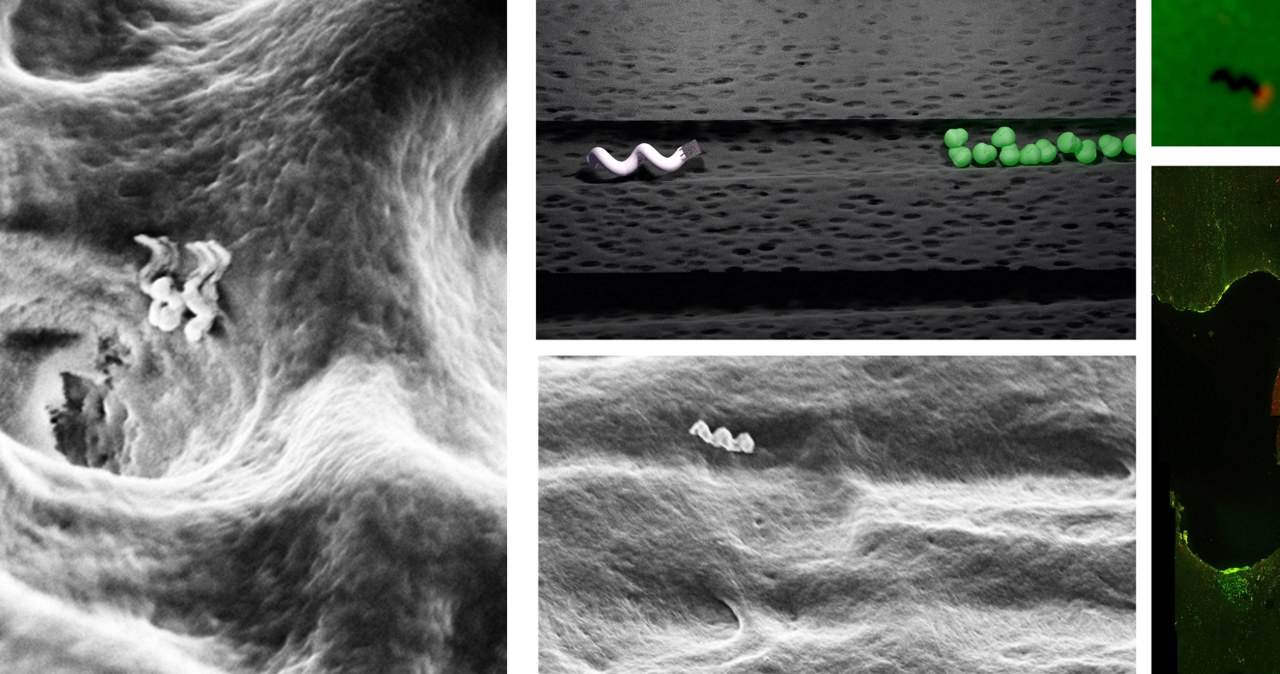 Nanoboty wnikające do kanalików zębinowych /materiały prasowe