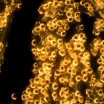 Nanocząsteczki złota zamiast klasycznej liposukcji