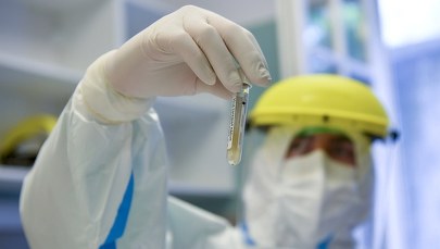 Nanoprzeciwciała lamy sposobem na walkę z Covid-19?