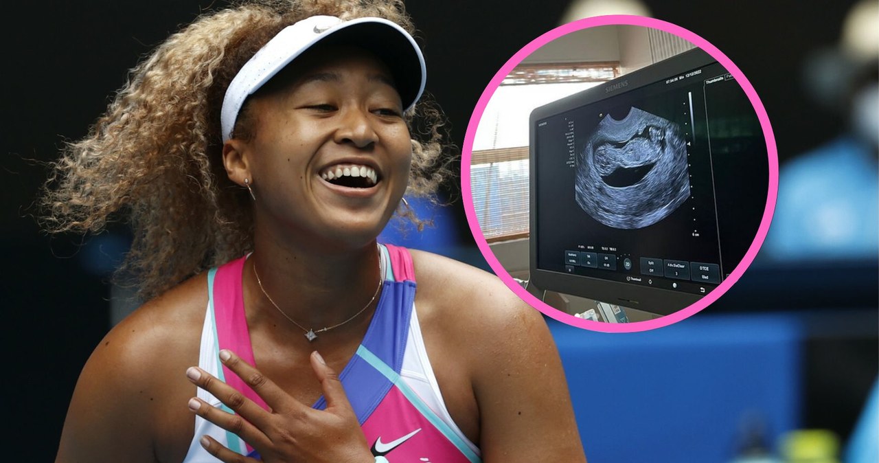 Naomi Osaka / AP/Associated Press/East News, Istagram @naomiosaka /East News