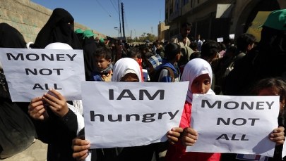 Nasila się dramat milionów ludzi. Dojdzie do wybuchu epidemii na ogromną skalę?
