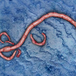 Następna pandemia. Co ją wywoła? Jest więcej groźnych mikrobów, niż sądzimy