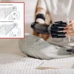 Nasz mózg nawet po latach od amputacji myśli, że dalej mamy utraconą kończynę 