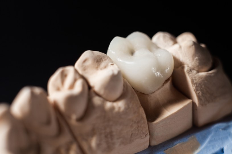 Nasze zęby są archiwum chorób. Naukowcy w 800-letnich zębach odkryli aktywne biologicznie przeciwciała (zdjęcie ilustracyjne) /hamara /123RF/PICSEL