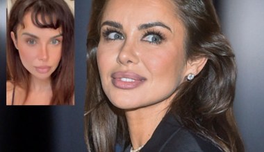 Natalia Siwiec posłuchała fanów i wygląda jak pieczarka. Jest co ratować?