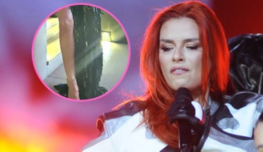 Natasza Urbańska pokazała stópkę. Ortopedzi biją na alarm!