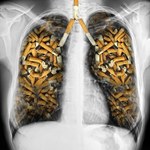 Naturalny sposób oczyszczenia płuc z nikotyny