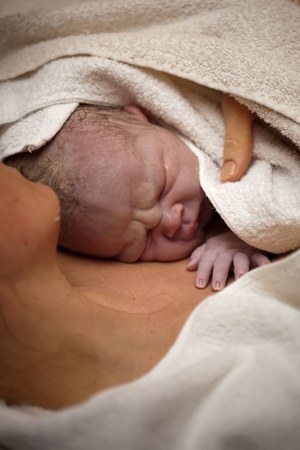 Natychmiastowy kontakt skóra do skóry po porodzie poprawia przeżywalność wcześniaków 