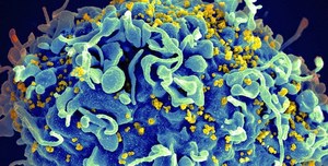 Naukowcy już wiedzą, jak walczyć z wirusem HIV