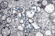 Naukowcy: Koronawirus wykorzystuje komórki w nosie, by wywołać infekcje