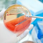 Naukowcy nie dowierzają. Superbakterie zabija cukier z… bakterii