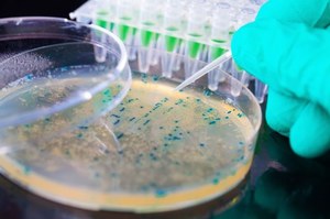 Naukowcy odkryli piętę achillesową szpitalnej superbakterii