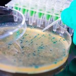 Naukowcy odkryli piętę achillesową szpitalnej superbakterii