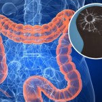 Naukowcy odkryli przyczynę utraty pamięci. Jest w jelitach i zaraża