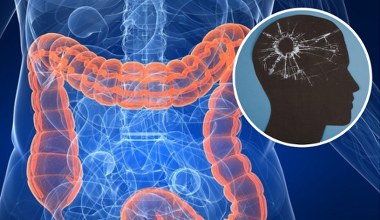 Naukowcy odkryli przyczynę utraty pamięci. Jest w jelitach i zaraża