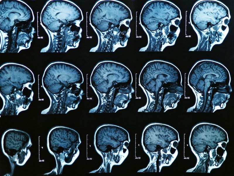 Naukowcy spodziewają się, że w ciągu pięciu lat będą potrafili dokonać elektronicznego zapisu sygnałów mózgowych /123RF/PICSEL