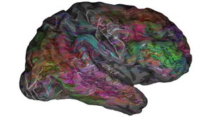 Naukowcy stworzyli mózgowy atlas słów