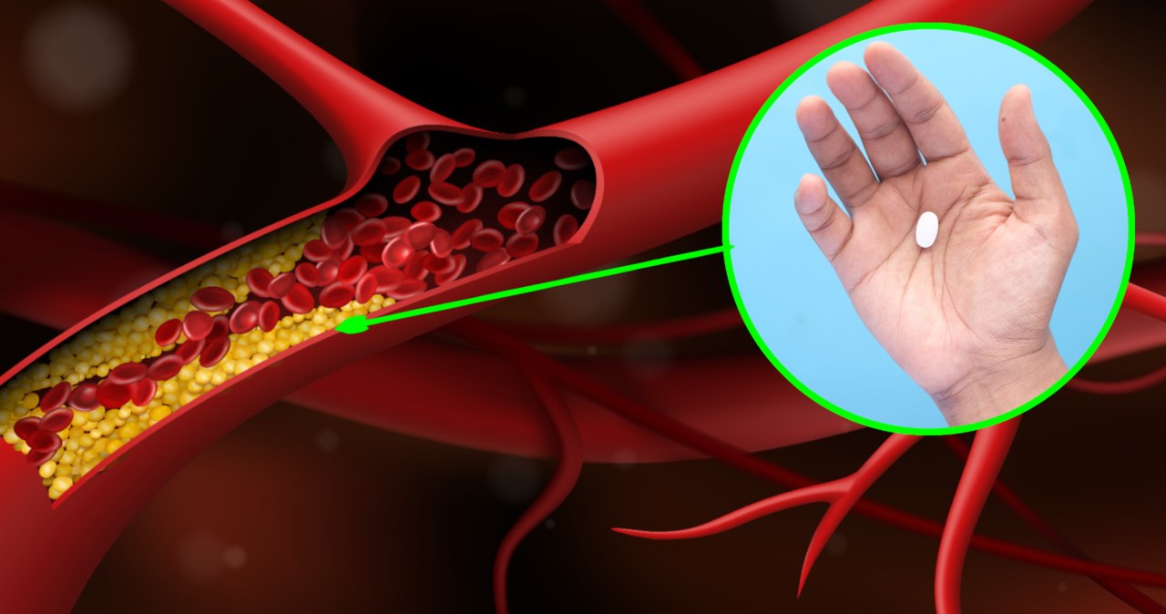 Naukowcy stworzyli nowy sposób zbijania cholesterolu. Wszystko zrobi jedna tabletka /123RF/PICSEL