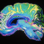 Naukowcy stworzyli prosty test na Alzheimera