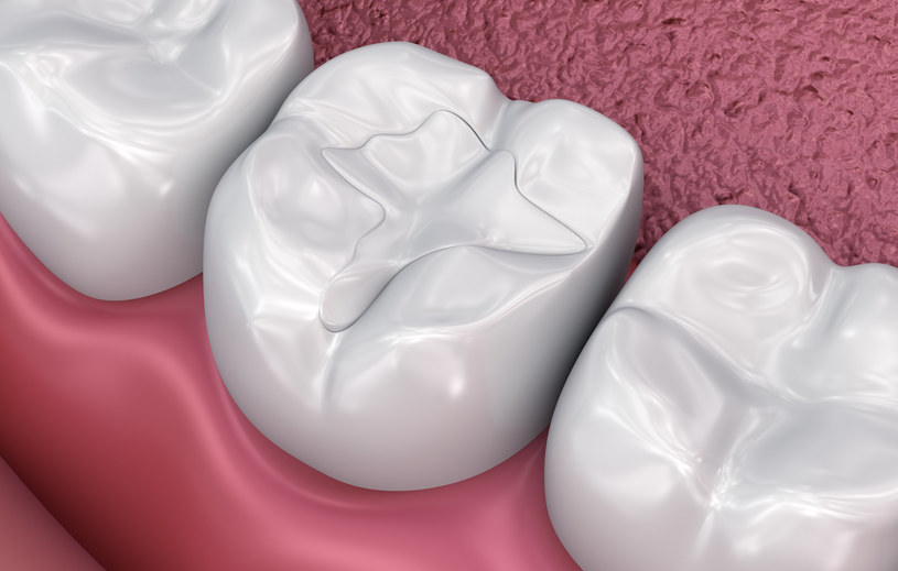 Naukowcy stworzyli sztuczne szkliwo - może zrewolucjonizować stomatologię /123RF/PICSEL
