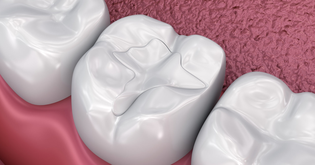 Naukowcy stworzyli sztuczne szkliwo - może zrewolucjonizować stomatologię /123RF/PICSEL
