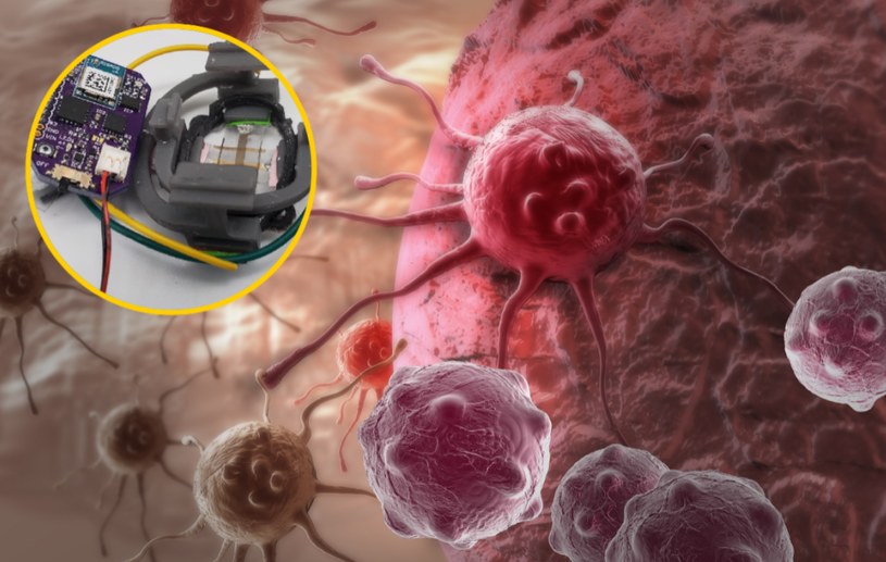 Naukowcy tworzą urządzenie do monitorowania nowotworów w czasie rzeczywistym /vitanovski /123RF/PICSEL